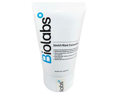 Biolabs Stretch Mark Concealer Review - For Reducing The Appearance Of Stretch Marks