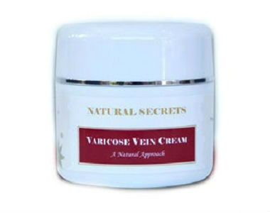 Natural Secrets Varicose Vein Cream Review - For Reducing The Appearance Of Varicose Veins