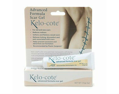 Kelocote Keloid Treatment Review - For Reducing The Appearance Of Scars