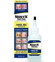NonyX Nail Gel Review - For Combating Nail Fungal Infections